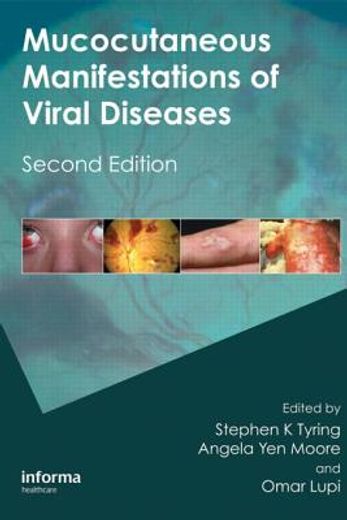 Mucocutaneous Manifestations of Viral Diseases: An Illustrated Guide to Diagnosis and Management (in English)