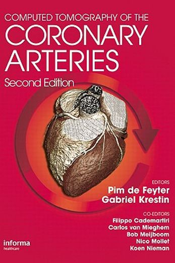 Computed Tomography of the Coronary Arteries (en Inglés)