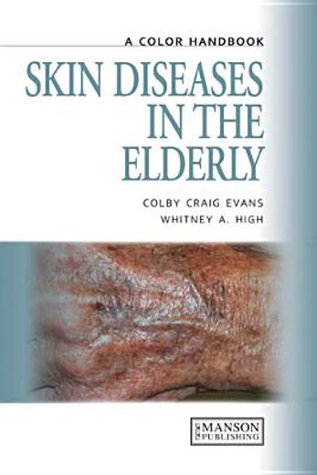 skin diseases in the elderly,a colour handbook