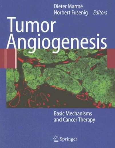 tumor angiogenesis,basic mechanisms and cancer therapy