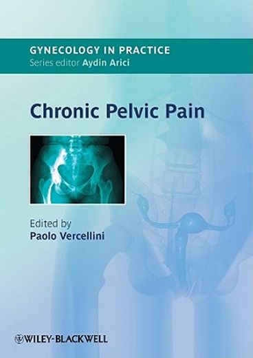 Chronic Pelvic Pain (en Inglés)