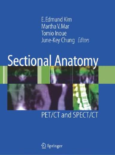 sectional anatomy,pet/ct and spect/ct