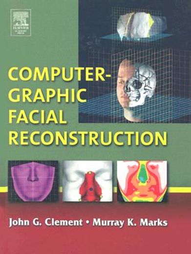 computer-graphic facial reconstruction