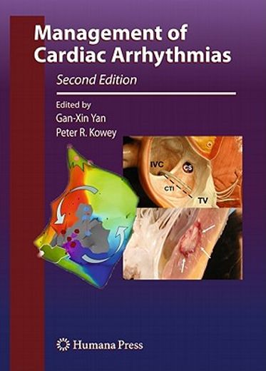Management of Cardiac Arrhythmias (en Inglés)