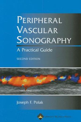 peripheral vascular sonography,a practical guide