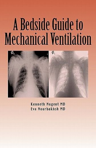 a bedside guide to mechanical ventilation