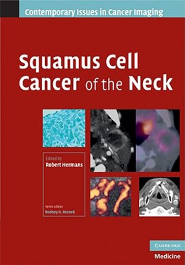 squamous cell cancer of the neck