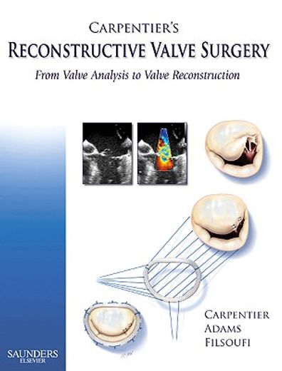carpentier´s reconstructive valve surgery,from valve analysis to valve reconstruction