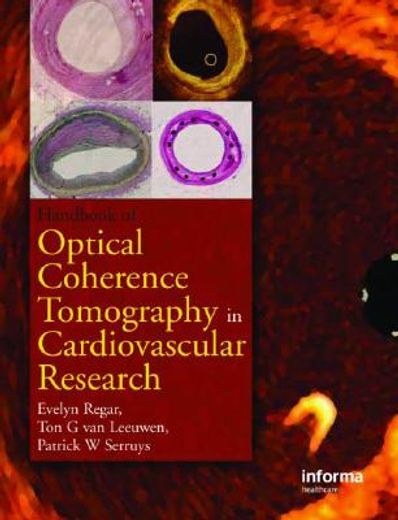 Optical Coherence Tomography in Cardiovascular Research (en Inglés)