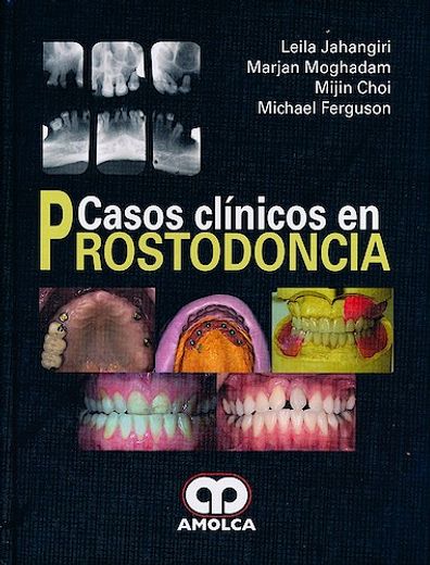 Casos Clínicos en Prostodoncia