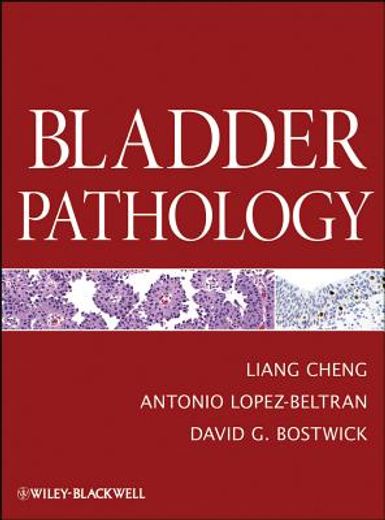 bladder pathology