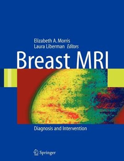 breast mri,diagnosis and intervention