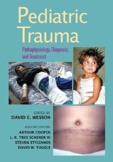 pediatric trauma,pathophysiology, diagnosis, and treatment