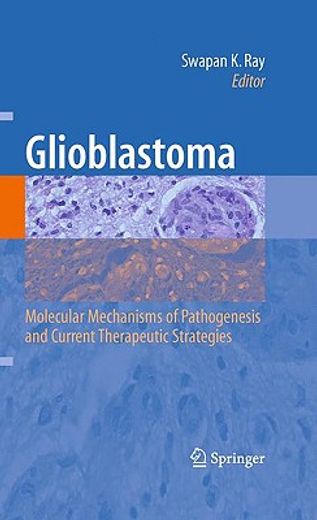 glioblastoma,molecular mechanisms of pathogenesis and current therapeutic strategies