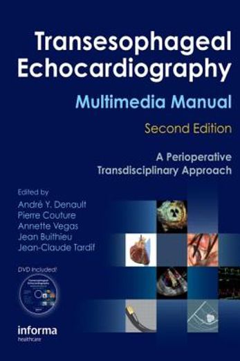 Transesophageal Echocardiography Multimedia Manual: A Perioperative Transdisciplinary Approach (en Inglés)