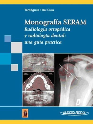 Monografía SERAM: Radiología ortopédica y radiología dental: una guía práctica (Tardáguila / Del Cura)
