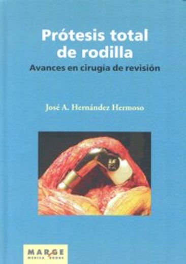 Avances en Cirugía de Revisión de la Prótesis Total de Rodilla (in Spanish)