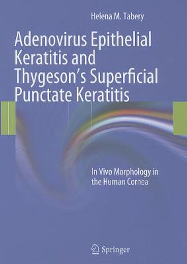 adenovirus epithelial keratitis and thygeson`s superficial punctate keratitis (en Inglés)