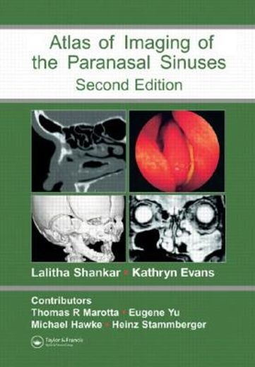 An Atlas of Imaging of the Paranasal Sinuses (en Inglés)