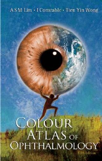 colour atlas of ophthalmology