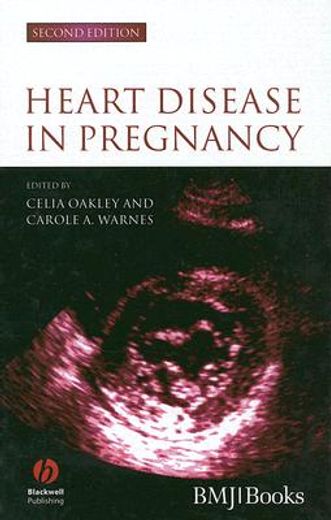 Heart Disease in Pregnancy (en Inglés)