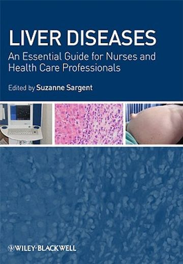 liver disease,an essential guide for nurses and health care professionals