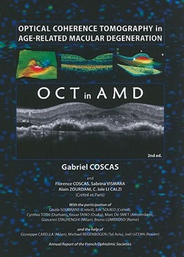 optical coherence tomography in age-related macular degeneration (in English)