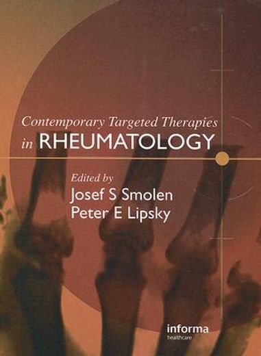 Contemporary Targeted Therapies in Rheumatology (en Inglés)