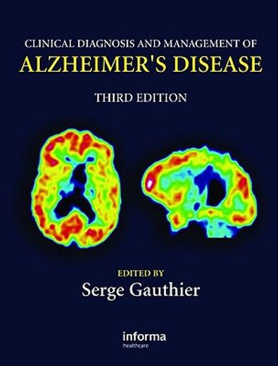 clinical diagnosis and management of alzheimer´s disease
