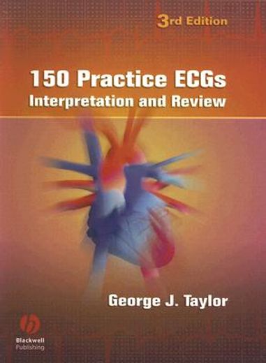 150 practice ecgs,interpretation and review
