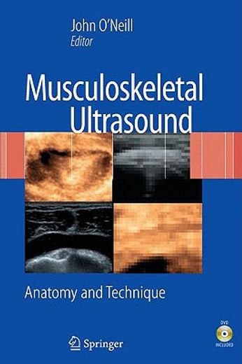 musculoskeletal ultrasound,anatomy and technique