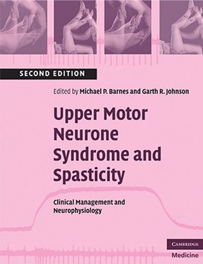 upper motor neurone syndrome and spasticity,clinical management and neurophysiology (en Inglés)