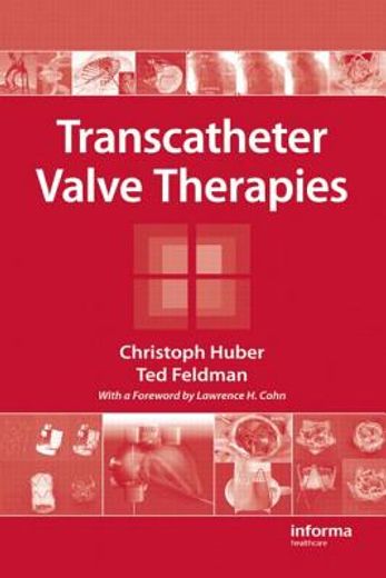 Transcatheter Valve Therapies (en Inglés)