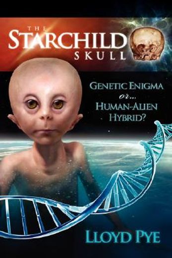 the starchild skull,genetic enigma or human-alien hybrid? (in English)
